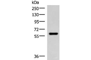 Western blot analysis of Mouse skeletal muscle tissue lysate using MYOT Polyclonal Antibody at dilution of 1:900 (Myotilin anticorps)