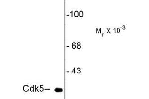 Western Blotting (WB) image for anti-Cyclin-Dependent Kinase 5 (CDK5) antibody (ABIN782438) (CDK5 anticorps)