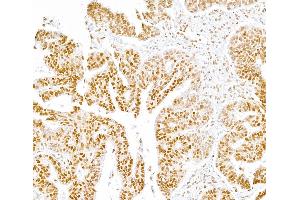Immunohistochemistry (IHC) image for anti-RNA Polymerase II (pSer5) antibody (ABIN7455032) (RNA Polymerase II anticorps  (pSer5))