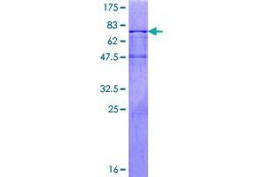 Image no. 1 for Dyslexia Susceptibility 1 Candidate 1 (DYX1C1) (AA 1-381) protein (GST tag) (ABIN1352220)