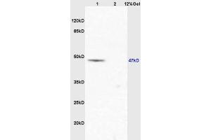 Lane 1: mouse lung lysates Lane 2: mouse stomach lysates probed with Anti EIF5 Polyclonal Antibody, Unconjugated (ABIN1387374) at 1:200 in 4 °C. (EIF5 anticorps  (AA 331-431))