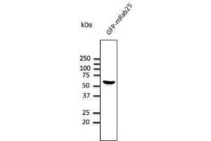 Anti-Rab2S Ab at 1/1,000 dilution, HEK293 cells transfected With GFP-Rab25, rabbit polyclonal to goat lµg (HRP) at 1/10,000 dilution, (RAB25 anticorps  (C-Term))