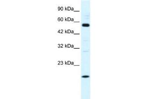 Human HepG2; WB Suggested Anti-ZNF436 Antibody Titration: 1. (ZNF436 anticorps  (N-Term))