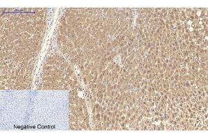 Immunohistochemical analysis of paraffin-embedded human liver tissue. (Catalase anticorps  (C-Term))