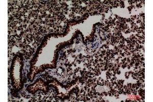 Immunohistochemistry (IHC) analysis of paraffin-embedded Mouse Lung, antibody was diluted at 1:100. (FOXP1 anticorps  (C-Term))
