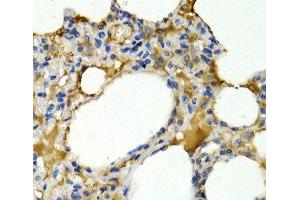 Immunohistochemistry of paraffin-embedded Rat lung using IL9 Polyclonal Antibody at dilution of 1:200 (40x lens). (IL-9 anticorps)