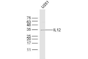 U251 lysates probed with IL12 Polyclonal Antibody, Unconjugated  at 1:300 dilution and 4˚C overnight incubation. (IL12 anticorps  (AA 51-150))
