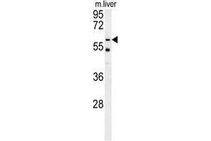 TYSND1 Antibody (C-term) western blot analysis in mouse liver tissue lysates (15 µg/lane). (TYSND1 anticorps  (C-Term))