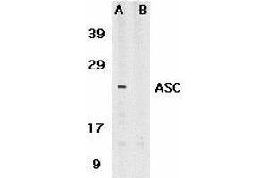 Immunocytochemistry of ASC in HL60 cells with ASC antibody at 5μg/ml. (PYCARD anticorps  (C-Term))