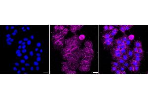 Immunocytochemical staining of HepG2 cells with pan Cadherin antibody (ABIN7797823), 1:1,000). (Recombinant Cadherin pan anticorps)