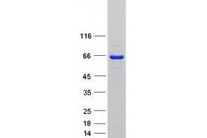 Validation with Western Blot