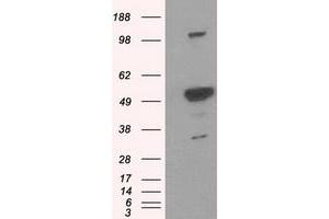 Western Blotting (WB) image for anti-Proteasome (Prosome, Macropain) 26S Subunit, ATPase, 3 (PSMC3) antibody (ABIN1501332) (PSMC3 anticorps)