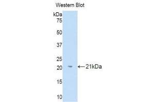 Western Blotting (WB) image for anti-Interleukin 18 Binding Protein (IL18BP) (AA 31-194) antibody (ABIN1859371) (IL18BP anticorps  (AA 31-194))