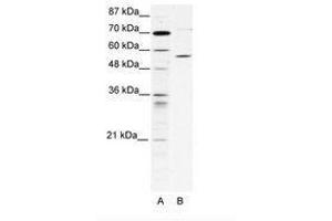 Image no. 1 for anti-Chaperonin Containing TCP1, Subunit 4 (Delta) (CCT4) (AA 453-502) antibody (ABIN202730) (CCT4 anticorps  (AA 453-502))