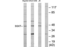 Western blot analysis of extracts from HepG2/Jurkat/COLO205 cells, using SSXT Antibody. (SS18 anticorps  (AA 1-50))