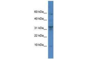 Image no. 1 for anti-Cathepsin C (CTSC) (AA 185-234) antibody (ABIN6746757) (CTSC anticorps  (AA 185-234))