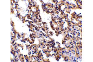 Immunohistochemistry (IHC) image for anti-Interleukin 21 Receptor (IL21R) (Extracellular Domain) antibody (ABIN1030836)