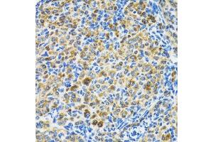Immunohistochemistry of paraffin-embedded rat ovary using HSPA9 antibody.