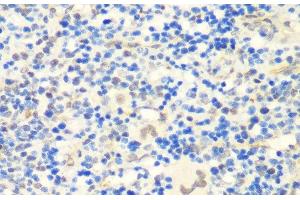 Immunohistochemistry of paraffin-embedded Rat spleen using CTCF Polyclonal Antibody at dilution of 1:200 (40x lens).