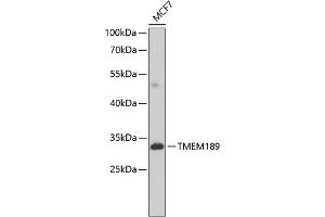 Western blot analysis of extracts of MCF-7 cells, using TMEM189 antibody (ABIN6134447, ABIN6149262, ABIN6149263 and ABIN6224423) at 1:1000 dilution. (TMEM189 anticorps  (C-Term))
