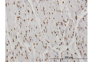 Immunoperoxidase of monoclonal antibody to TAF11 on formalin-fixed paraffin-embedded human smooth muscle. (TAF11 anticorps  (AA 158-210))
