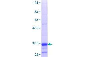 Image no. 1 for Solute Carrier Family 22 (Organic Anion/urate Transporter), Member 12 (SLC22A12) (AA 281-349) protein (GST tag) (ABIN1320195)