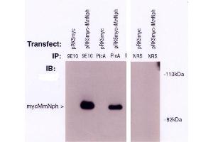 Image no. 1 for anti-Nephronophthisis 1 (Juvenile) (NPHP1) antibody (ABIN264966) (NPHP1 anticorps)