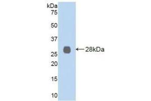 Detection of Recombinant LOXL2, Human using Polyclonal Antibody to Lysyl Oxidase Like Protein 2 (LOXL2) (LOXL2 anticorps  (AA 544-751))