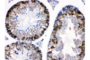 nti- Stathmin 1 Picoband antibody, IHC(P) IHC(P): Mouse Testis Tissue