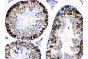 nti- Stathmin 1 Picoband antibody, IHC(P) IHC(P): Mouse Testis Tissue (Stathmin 1 anticorps  (N-Term))