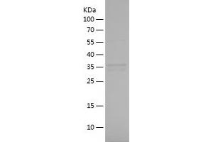 Western Blotting (WB) image for Cyclin-Dependent Kinase 1 (CDK1) (AA 179-297) protein (His-IF2DI Tag) (ABIN7122525)