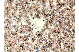 Immunohistochemical staining of paraffin-embedded Human liver tissue using anti-THOP1 mouse monoclonal antibody. (Thimet Oligopeptidase 1 anticorps)