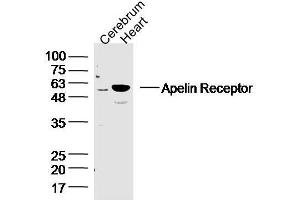 Mouse cerebrum and heart lysates probed with APJ Receptor Polyclonal Antibody, unconjugated  at 1:300 overnight at 4°C followed by a conjugated secondary antibody at 1:10000 for 90 minutes at 37°C.