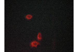 ABIN6268640 staining lovo cells by ICC/IF.