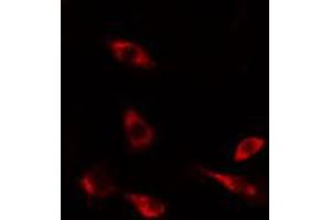 ABIN6274489 staining HeLa cells by IF/ICC. (DUSP9 anticorps  (Internal Region))