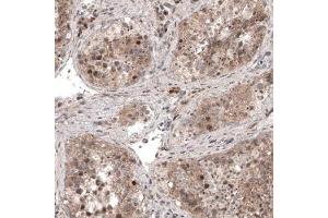 Immunohistochemical staining (Formalin-fixed paraffin-embedded sections) of human testis shows moderate cytoplasmic immunoreactivity in seminiferous tubules cells.