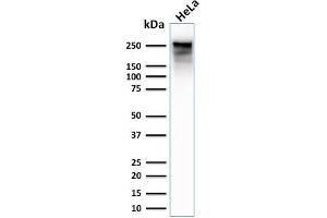 Western Blot Analysis of Human HeLa cell lysate using Spectrin Beta 3 Rabbit Monoclonal Antibody (SPTBN2/2979R).