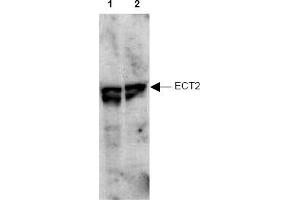 Image no. 1 for anti-Epithelial Cell Transforming Sequence 2 Oncogene (ECT2) (AA 785-795), (pThr790) antibody (ABIN401345) (ECT2 anticorps  (pThr790))