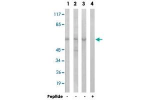 Western blot analysis of extracts from HeLa cells (Lane 1), Jurkat cells (Lane 2) and A-549 cells (Lane 3 and lane 4), using AGBL4 polyclonal antibody . (AGBL4 anticorps)