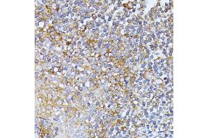 Immunohistochemistry of paraffin-embedded human tonsil using EIF2B2 antibody (ABIN6132131, ABIN6140037, ABIN6140038 and ABIN6222805) at dilution of 1:100 (40x lens). (EIF2B2 anticorps  (AA 1-351))