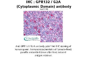 Image no. 1 for anti-G Protein-Coupled Receptor 132 (GPR132) (2nd Cytoplasmic Domain) antibody (ABIN1734928) (G Protein-Coupled Receptor 132 anticorps  (2nd Cytoplasmic Domain))