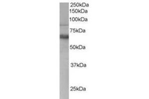 Image no. 1 for anti-anthrax Toxin Receptor 1 (ANTXR1) (C-Term) antibody (ABIN374464) (ANTXR1 anticorps  (C-Term))