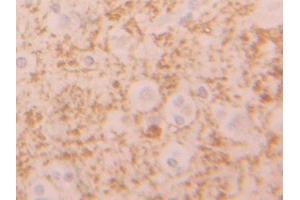 Used in DAB staining on fromalin fixed paraffin-embedded Liver tissue