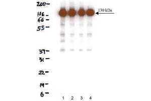 Western Blotting (WB) image for anti-Cadherin 2 (CDH2) (AA 802-819) antibody (ABIN968250) (N-Cadherin anticorps  (AA 802-819))