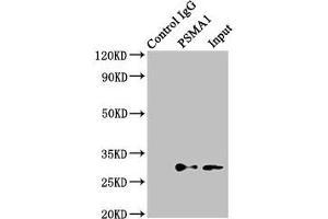 Immunoprecipitating PSMA1 in K562 whole cell lysate Lane 1: Rabbit control IgG (1 μg) instead of ABIN7164944 in K562 whole cell lysate.