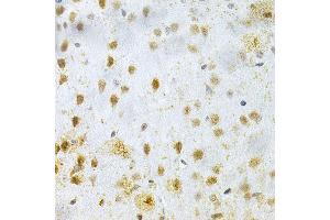 Immunohistochemistry of paraffin-embedded mouse brain using M Antibody (ABIN3016264, ABIN3016265, ABIN3016266, ABIN1680752 and ABIN6219676) at dilution of 1:200 (40x lens).