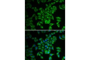 Immunofluorescence analysis of A549 cell using FXN antibody.