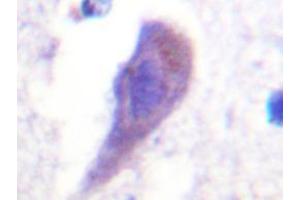 Immunohistochemistry analyzes of HRS Antibody in paraffin-embedded human brain tissue. (HGS anticorps)