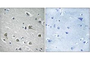Immunohistochemistry analysis of paraffin-embedded human brain tissue, using MYLIP Antibody. (MYLIP anticorps  (AA 161-210))