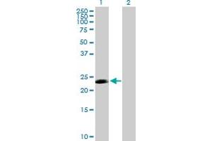Western Blot analysis of CDC20B expression in transfected 293T cell line by CDC20B MaxPab polyclonal antibody. (CDC20B anticorps  (AA 1-192))